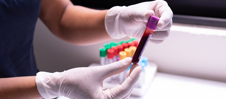 Dlonie w rekawiczkach laboratoryjnych trzymajace probowke z krwia nad stojakiem z kolorowymi probowkami